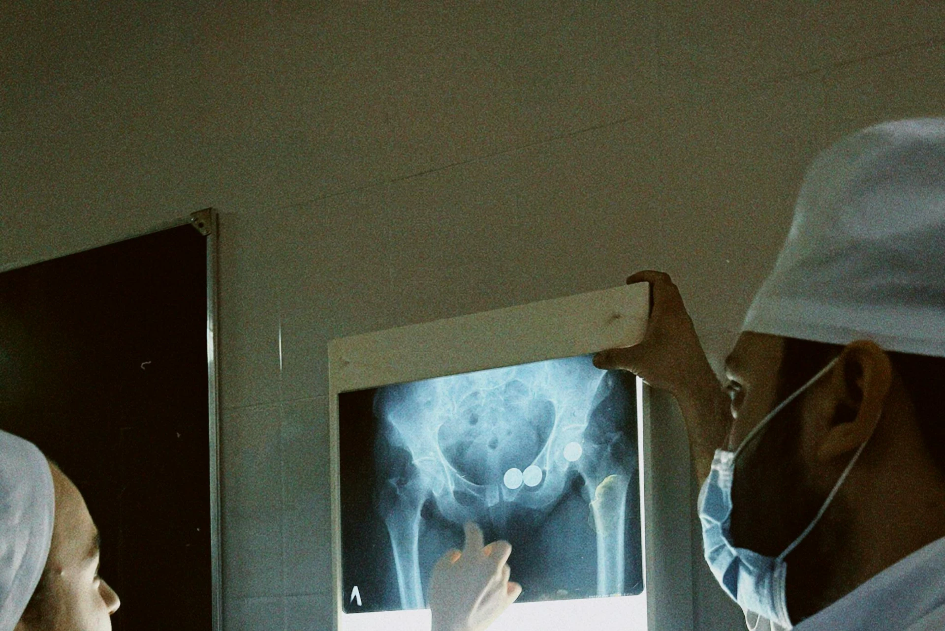 Joint Replacement Picture